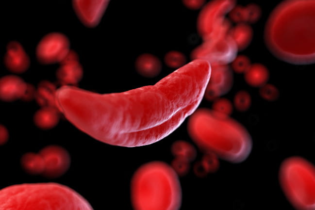An image of a sickle cell.
