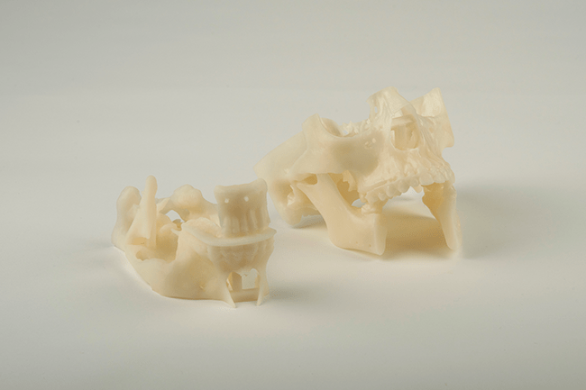 3D printed Jaw in a Day
