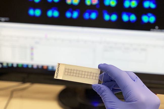Purple-gloved hand holding GlycoPath in front of computer screen