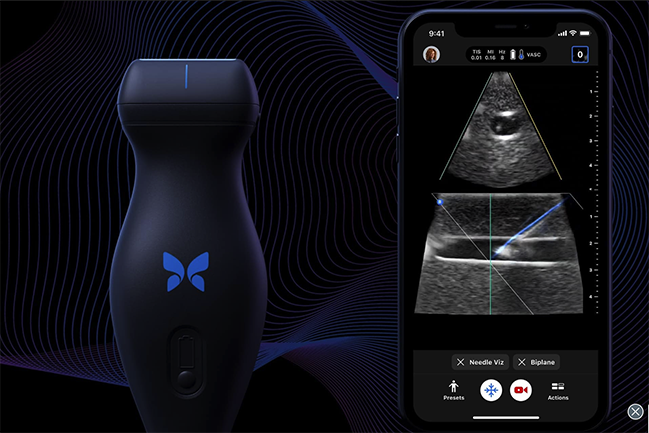 Butterfly and iPhone with ultrasound