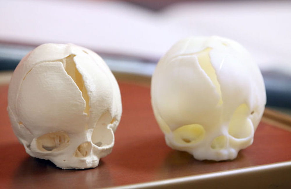 Replicas of Rhett Bausmith's skull were printed on two different 3-D printers at MUSC