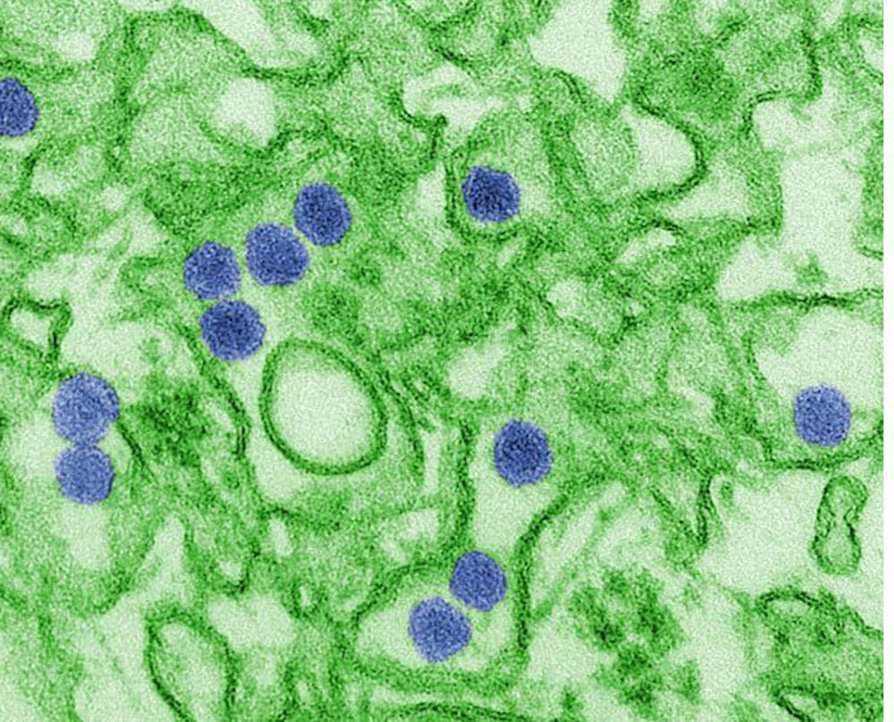 Shows Zika virus particles, digitally colored blue
