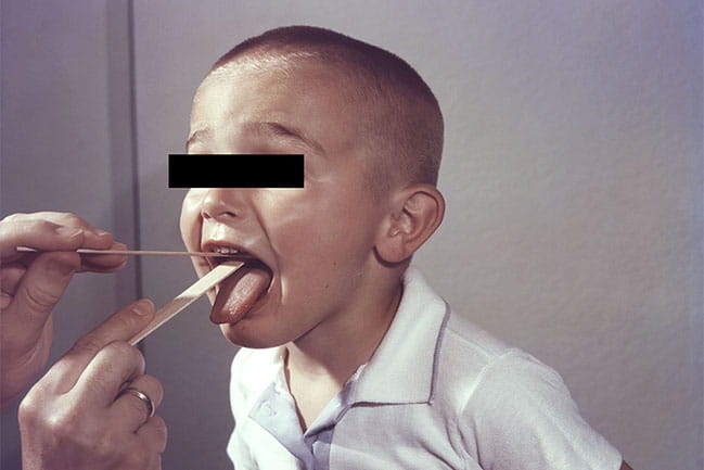 A boy gets his throat examined