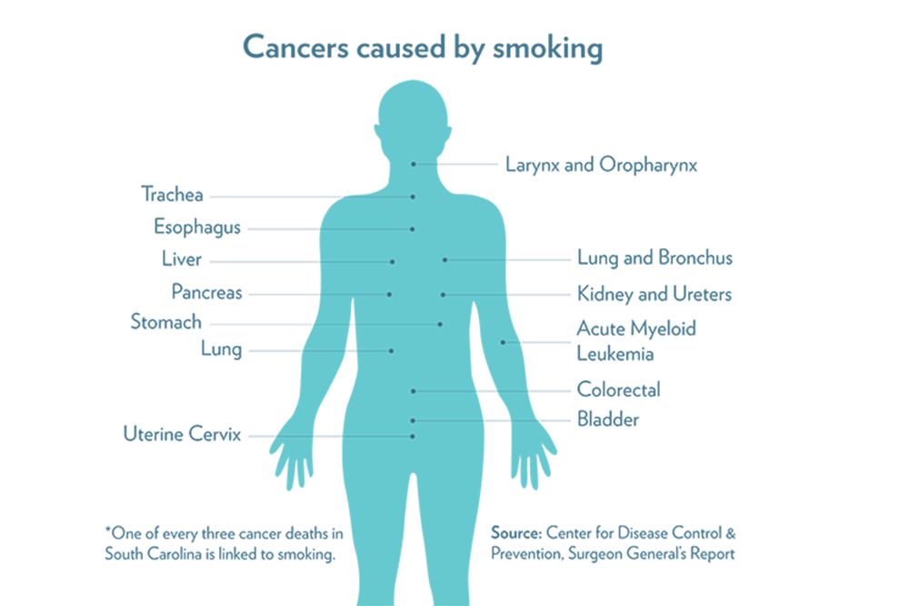 what are the most common cancers caused by smoking