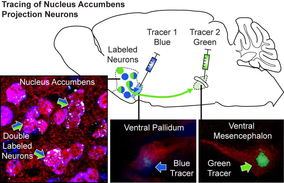 Tracings of nucleus accumbens projection neurons