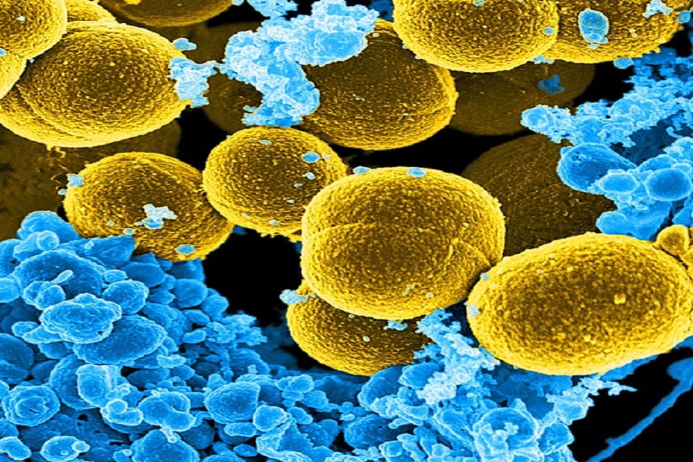 Scanning electron microscopic image of Staphylococcus aureus bacteria escaping white blood cells