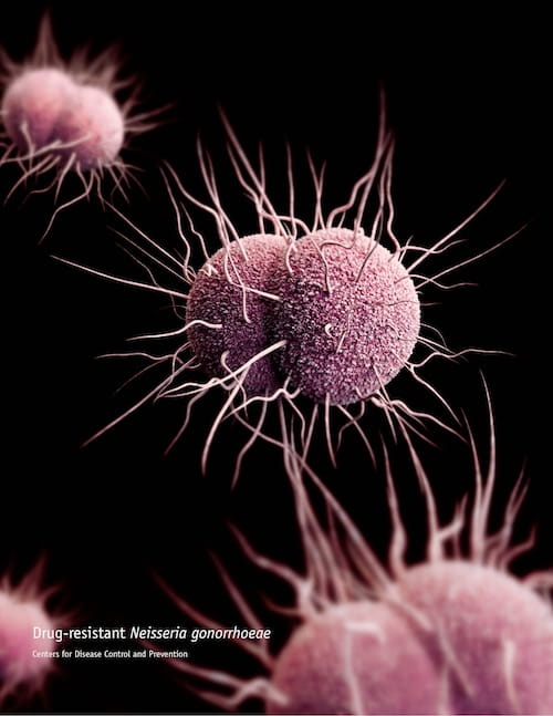 This illustration depicts a 3D computer-generated image of a number of drug-resistant, Neisseria gonorrhoeae diplococcal bacteria.The artistic recreation by Alissa Eckert was based upon scanning electron microscopic imagery.