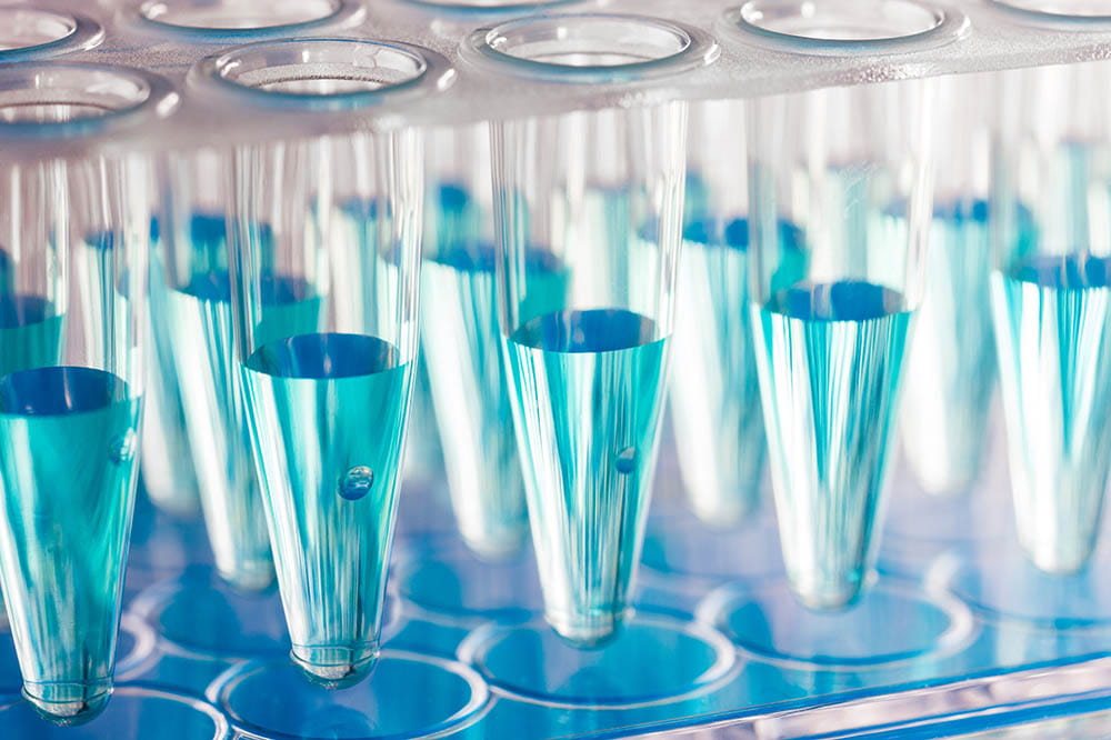 test tubes filled with blue liquid lined up in a rack