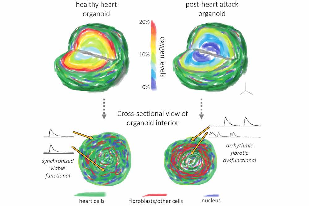 Low oxygen (10%) cell culture conditions combined with human heart organoids recreate tissue-level features a post-heart attack heart to better understand heart failure and improve drug testing for patients with heart failure. Image courtesy of Dylan Richards.