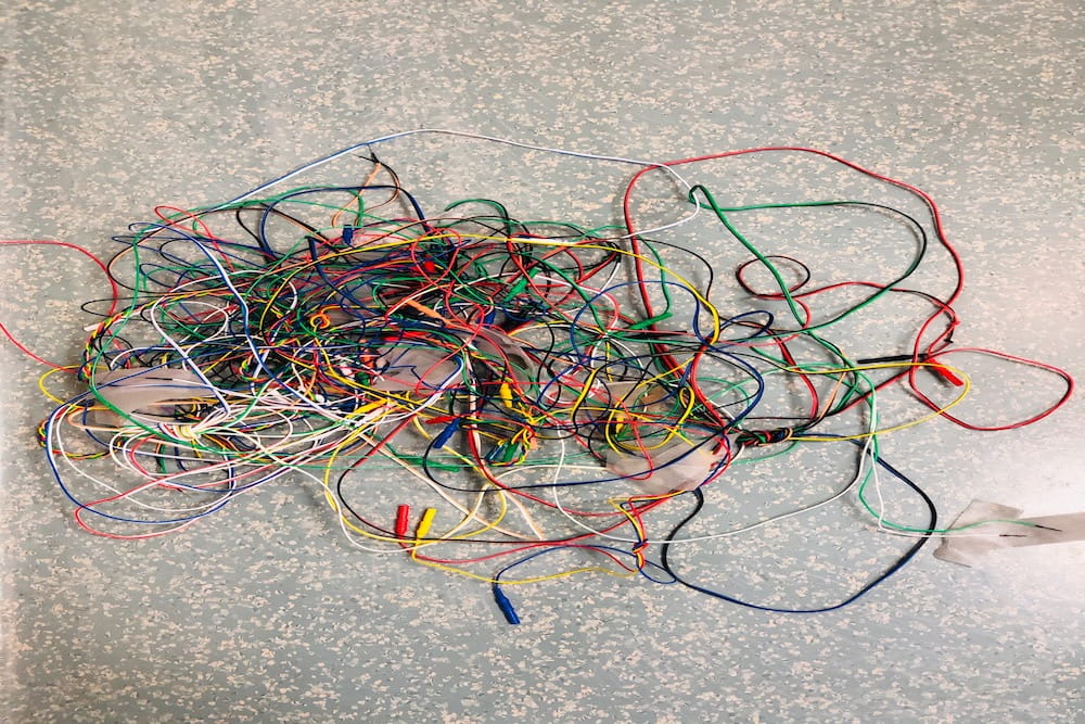 Messy intraoperative monitoring needles, after use. Image courtesy of Dr. Jessica Barley.