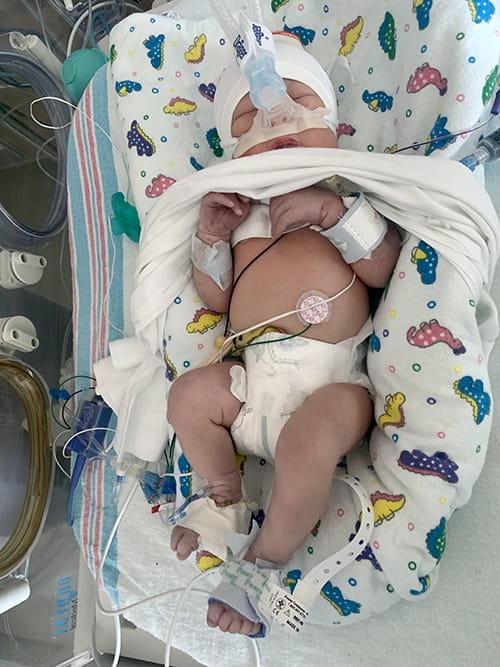 a small baby is has electrodes and a CPAP attached to him in a hospital bed
