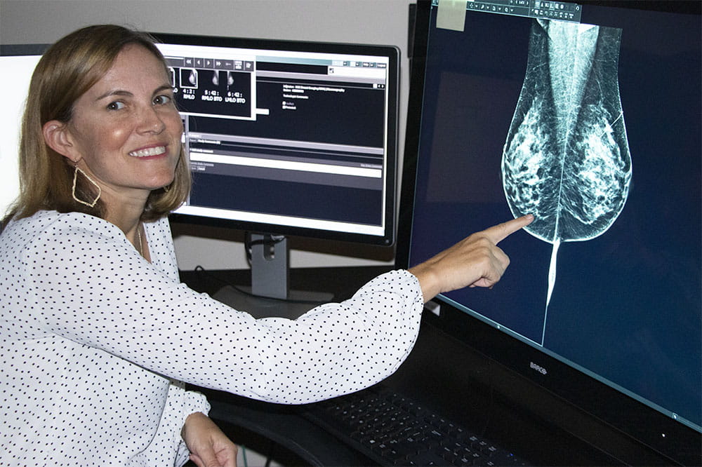Example images of the four breast density/composition categories