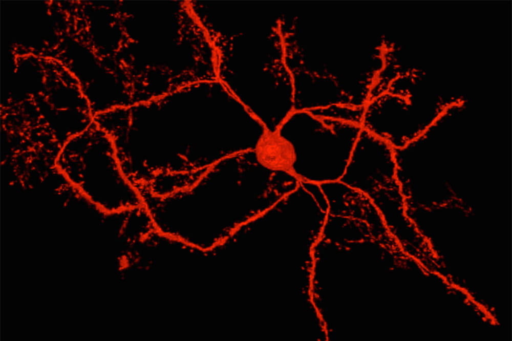 image of a neuron, dyed red, with long tentacles like an octopus