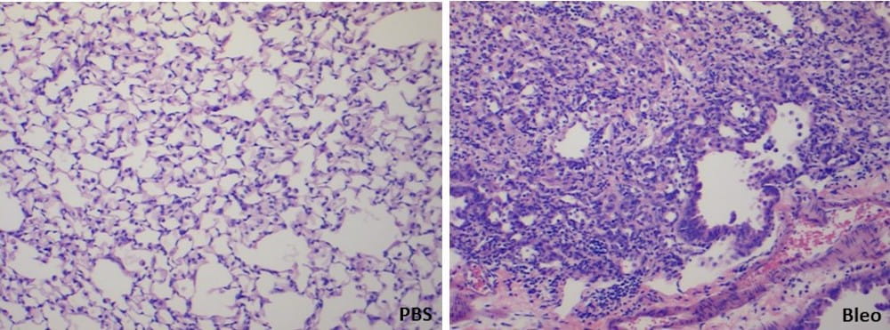 Slides showing bleomycin-induced pulmonary fibrosis in a mouse model of fibrosis.