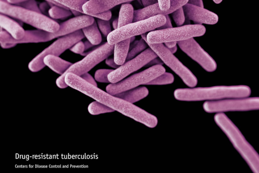 This illustration depicts a 3D computer-generated image of a cluster of rod-shaped, drug-resistant, Mycobacterium tuberculosis bacteria, the pathogen responsible for causing the disease tuberculosis (TB). Image courtesy of CDC.