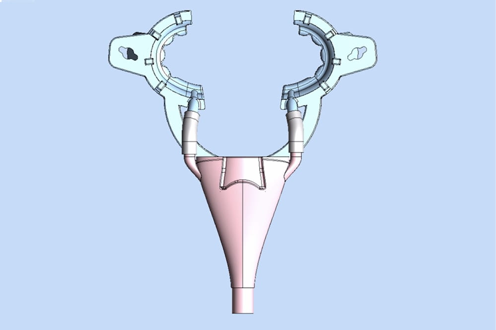 Diagram of lip retraction device created by Dr. Walter Renne.
