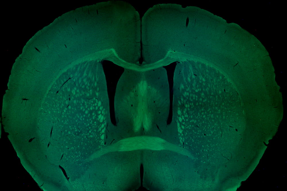 Coronal section of a mouse brain, with several major axonal tracts stained in green. Image courtesy of Dr. Ahlem Assali.