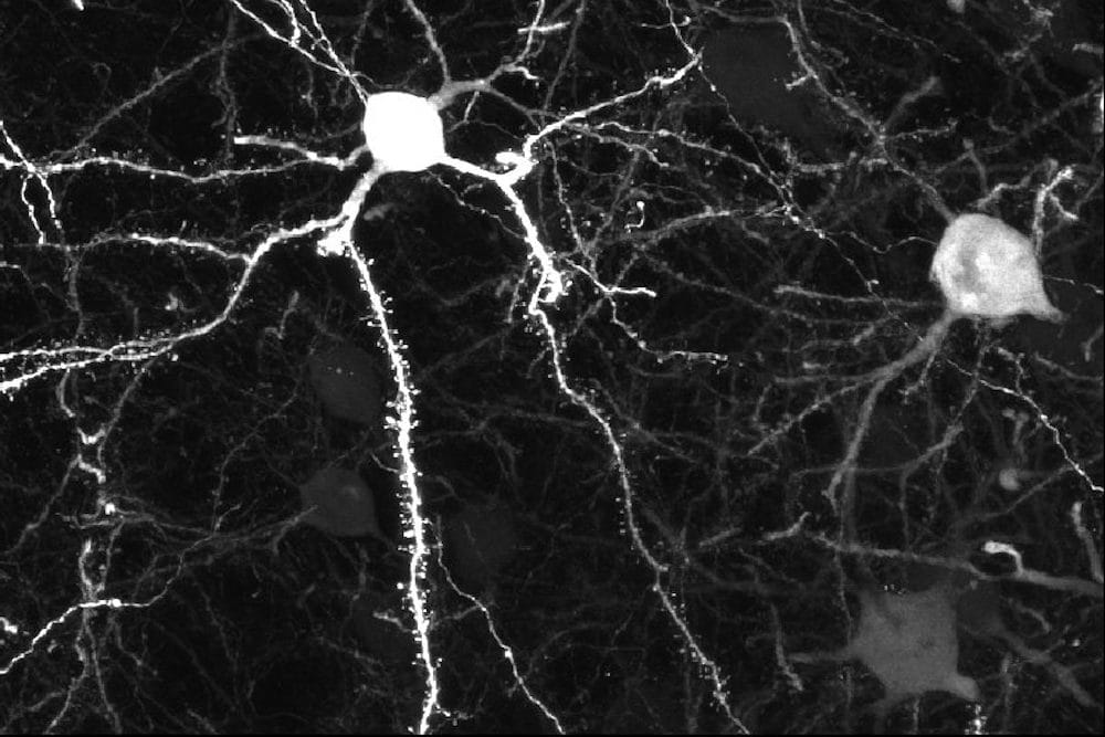 Neuron. Image courtesy of Dr. Ahlem Assali