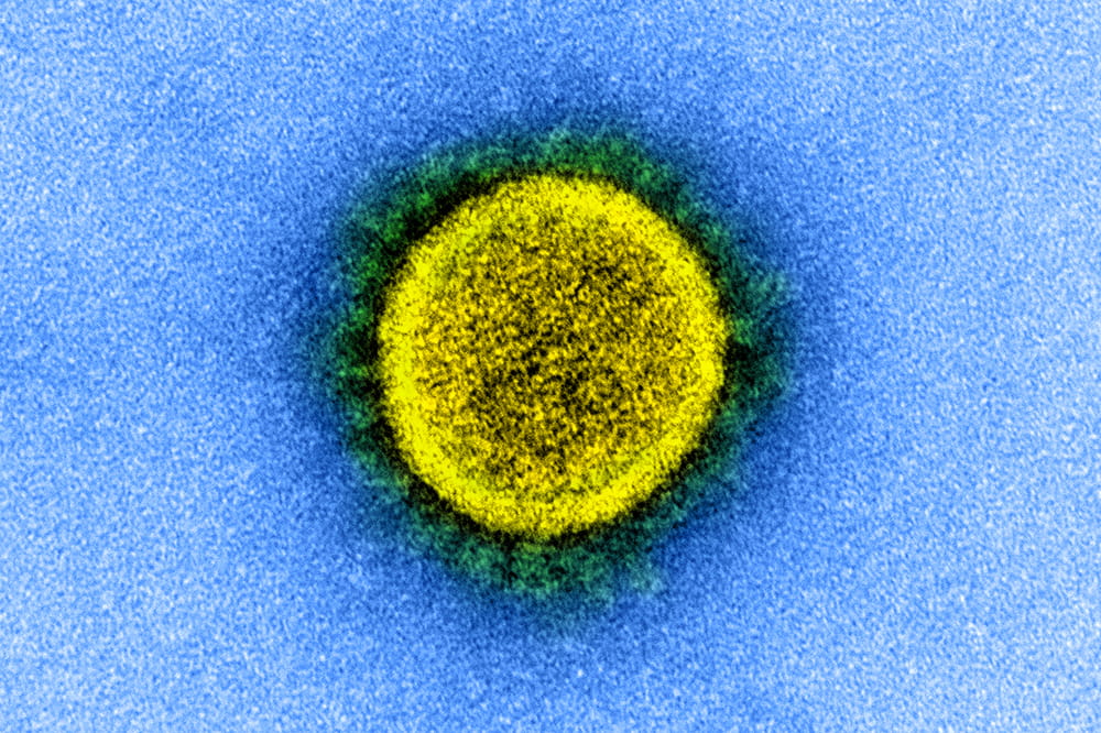 A coronavirus particle isolated from a patient. Image captured and color enhanced by the National Institute of Allergy and Infectious Diseases.