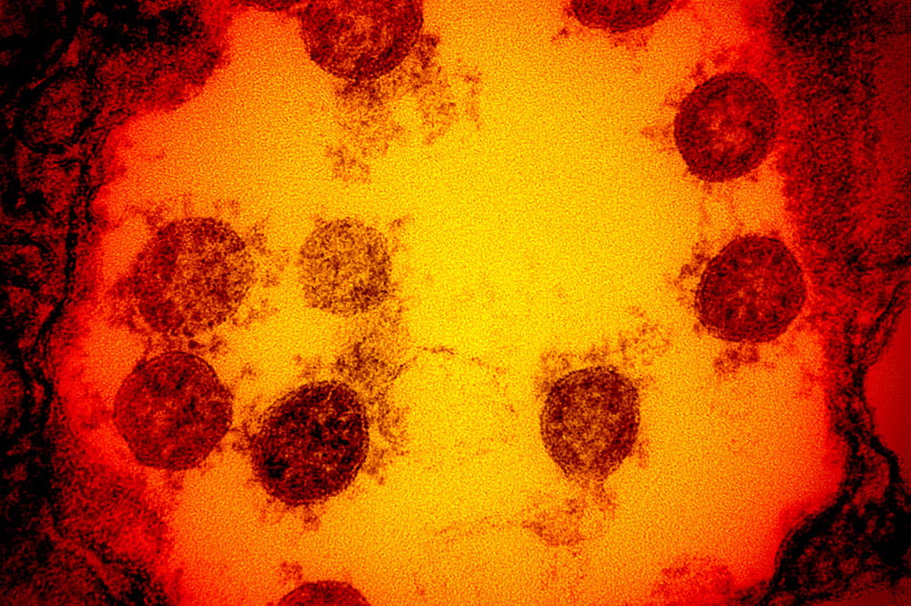 Micrograph of SARS-CoV-2 virus particles isolated from a patient.