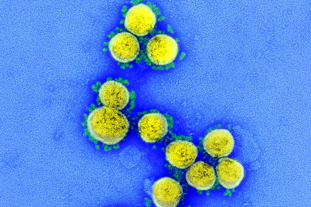 Transmission electron micrograph of coronavirus particles. Credit: NIAID