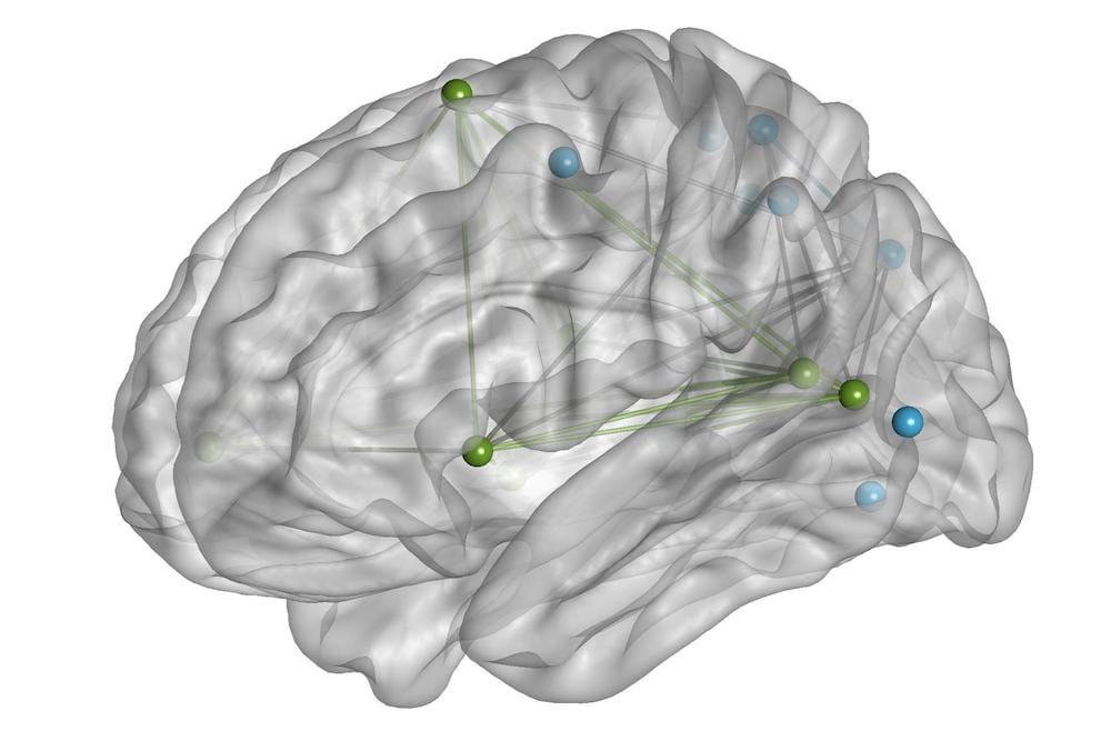 The VAN-DAN network of the brain.