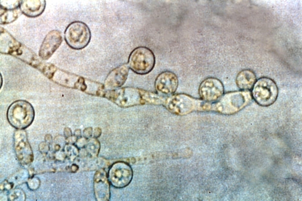 Candida albicans. Image by  Graham Colm. Creative Commons Attribution Share Alike 3  License. https://creativecommons.org/licenses/by-sa/3.0/