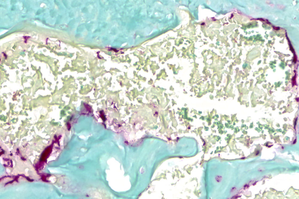 Bone resorbing cells (osteoclasts; purple) are prevalent in molars within the context of the normal oral microbiome.
