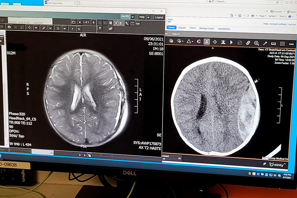a shot of a computer screen with two brain scans pulled up