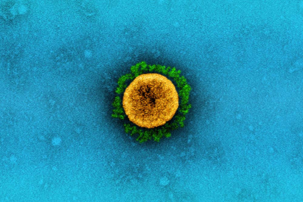 Transmission electron micrograph of a SARS-CoV-2 virus particle. Image captured at the NIAID Integrated Research Facility (IRF) in Fort Detrick, Maryland. Credit: NIAID
