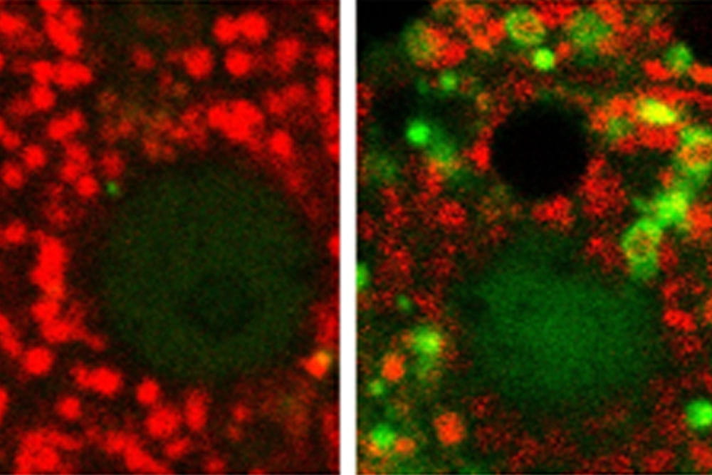 Immunofluorescence microscopy showing mitochondria (red) undergoing mitophagy (green) in ethanol treated liver cells (right).