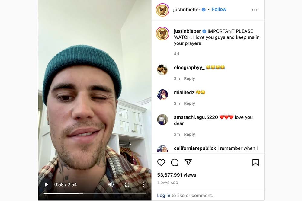 Singer Justin Bieber posts on Instagram about his partial facial paralysis. He's demonstrating how one side of his face doesn't move properly.