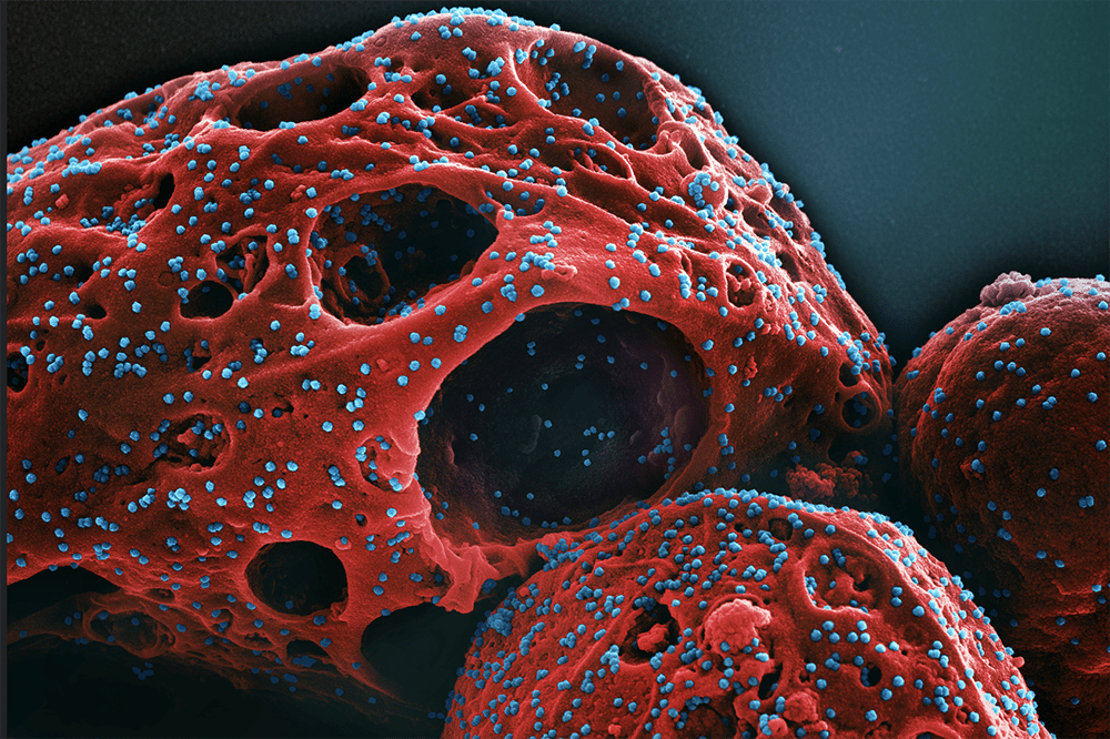 Red balls with holes in them representing the coronavirus.