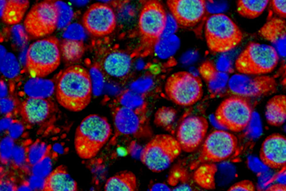 Expression of the MEF2C protein (green) in the nuclei of neuronal cells (stained with a neuronal marker protein in red) in the inner ear of a young adult mouse. Nuclei were stained with Dapi (blue). Image courtesy of Dr. Hainan Lang.