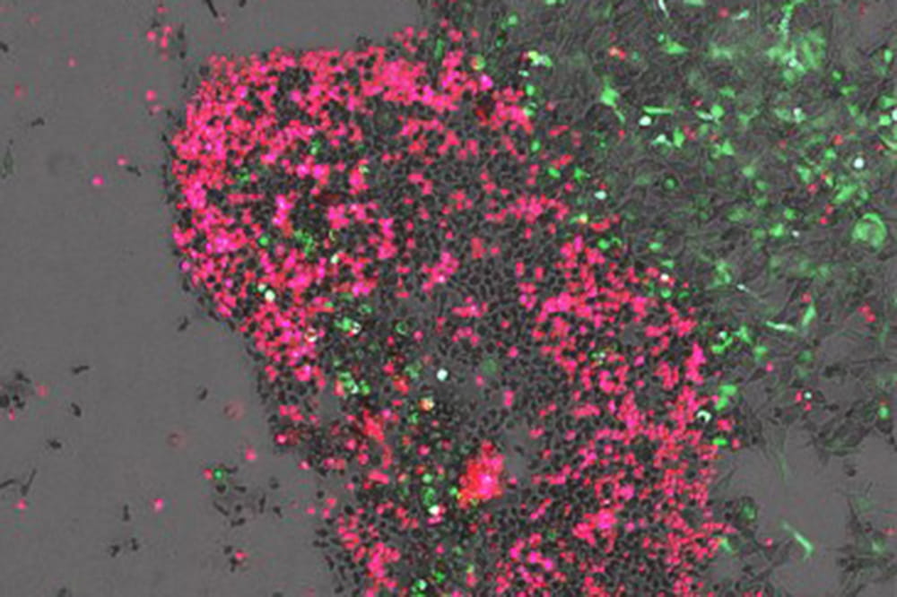 microscopic image of cells the green cells are attacking the pink cells and the pink cells are dying and turning black