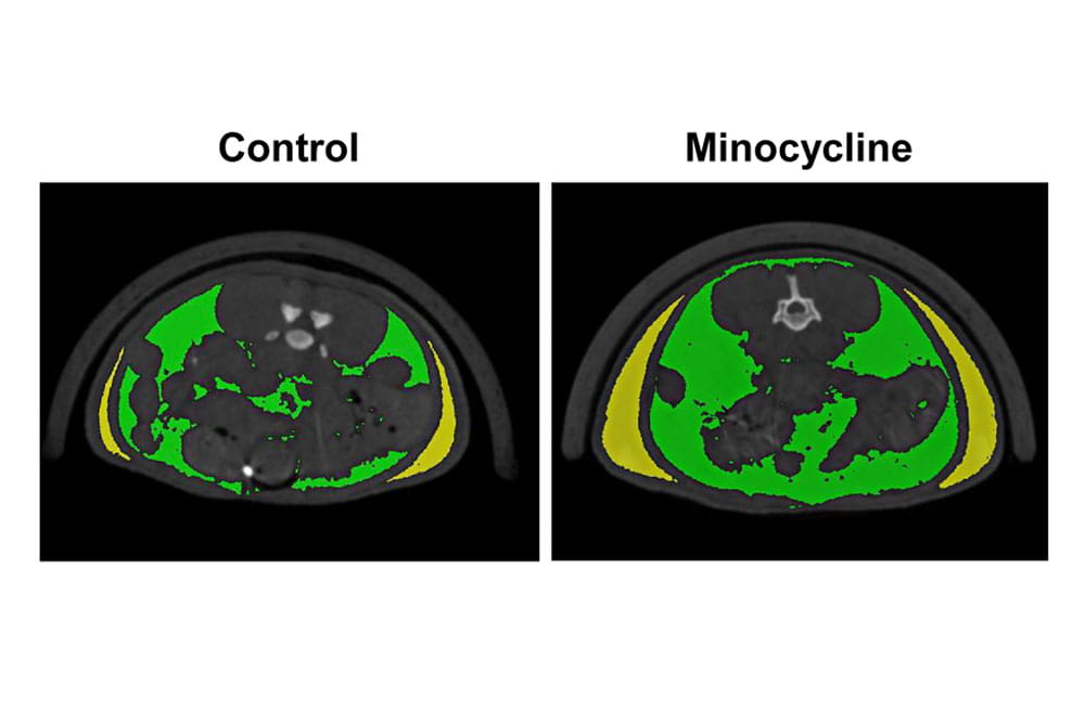 Minocycline treatment increases fat accumulation.
