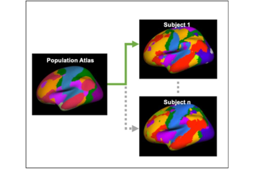 Individualized functional networks, created by mapping a population-level atlas to each participant’s brain, were used to detect early Alzheimer’s-related changes in brain function and cognition. Image provided by Dr. Stephanie Fountain-Garagoza.