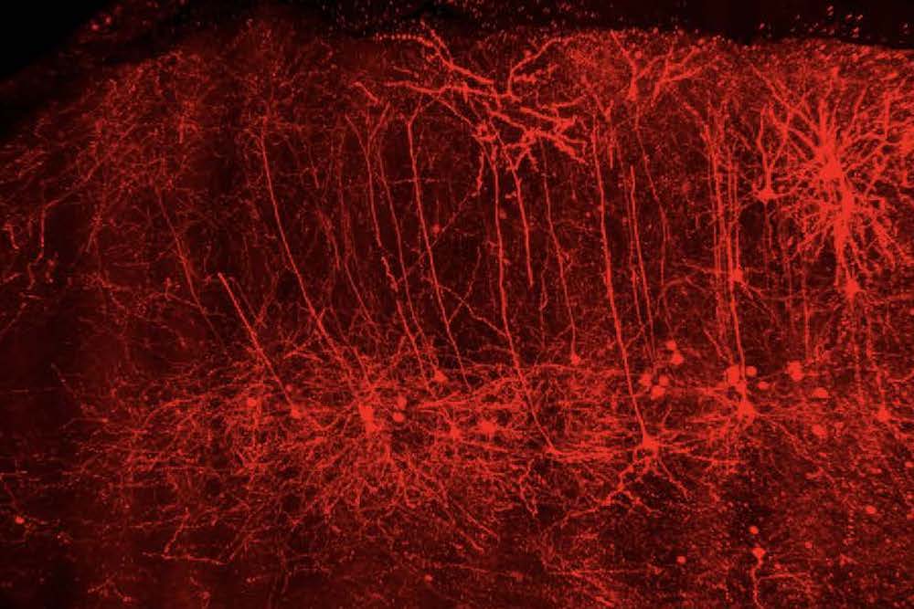 Pyramidal neurons in the prefrontal cortex labeled with a retrograde virus tagged with mCherry.