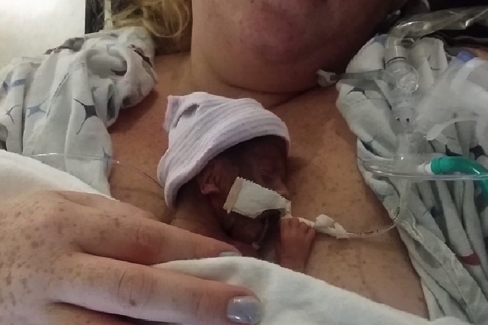 Teeny tiny newborn baby on mom's chest 