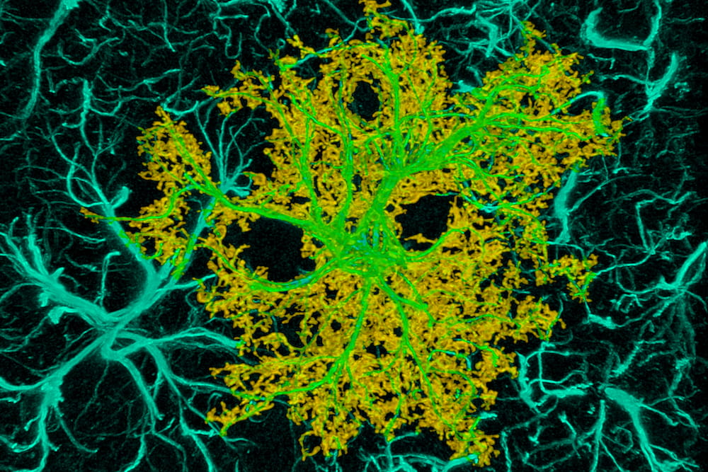 An astrocyte, a type of non-neuronal cell, in the rodent cortex. The outer boundary of the cell is shown in yellow; the cell “skeleton” in teal. Image courtesy of Dr. Michael D. Scofield.