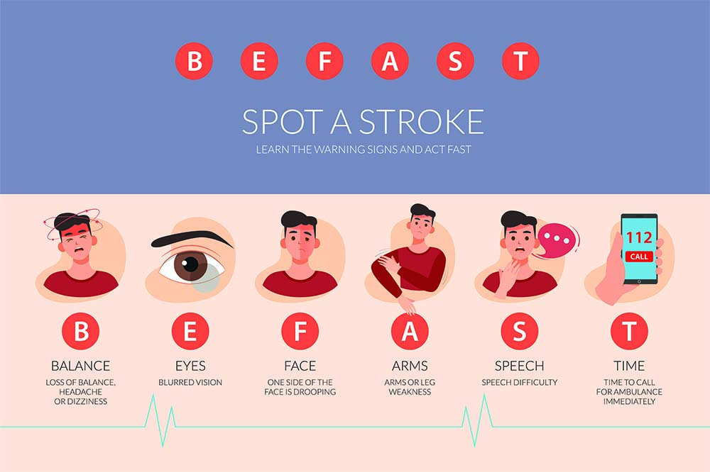 Graphic that says BE FAST. Spot a stroke. Learn the warning signs and act fast. B: balance. Loss of balance, headache or dizziness. E: eyes. Blurred vision. F: face. One side of the face is drooping. A: arms. Arm or leg weakness. S: speech. Speech difficulty. T: time. Time to call for ambulance immediately.