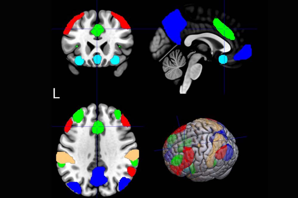Four images of brains with areas lit up in blue, yellow, green and red.