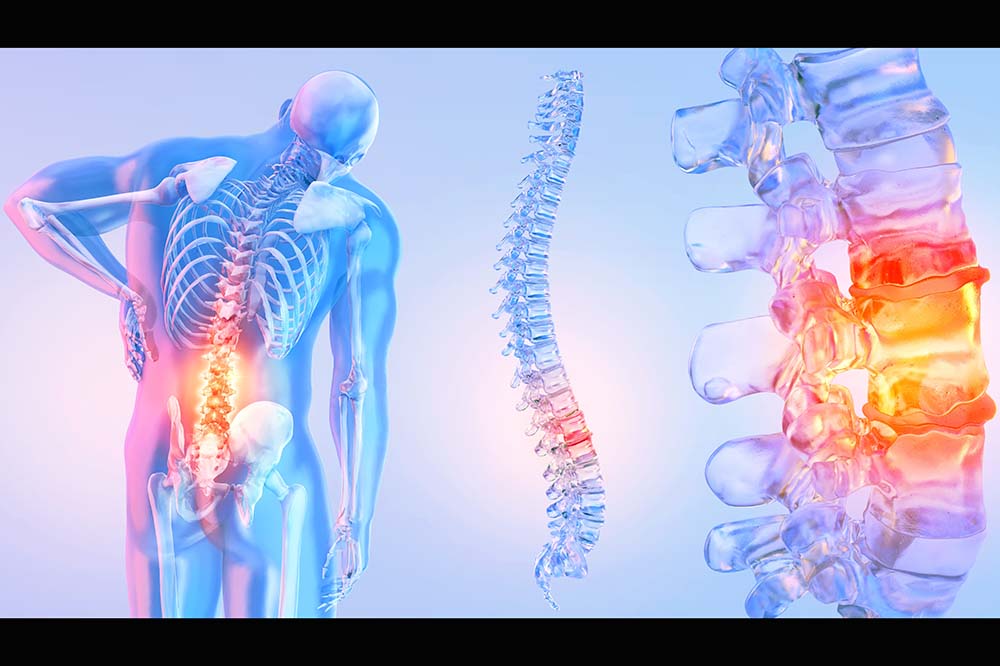 Illustration of the back of a person's body highlighting in yellow the lower part of the back.